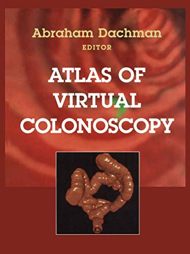9780387955117: Atlas of Virtual Colonoscopy