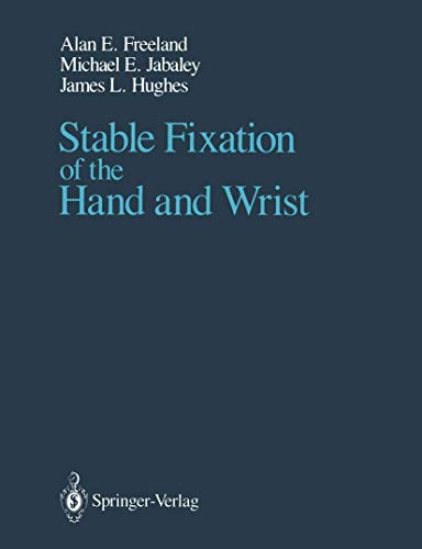 9780387963006: Stable Fixation of the Hand and Wrist