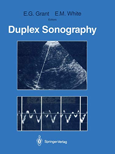 9780387965642: Duplex Sonography