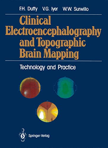 Stock image for Clinical Electroencephalography and Topographic Brain Mapping: Technology and Practice for sale by Friends of  Pima County Public Library