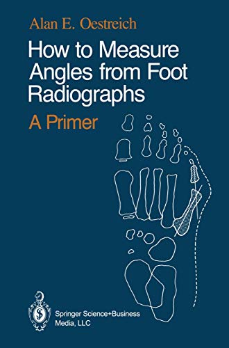 9780387971070: How to Measure Angles from Foot Radiographs: A Primer