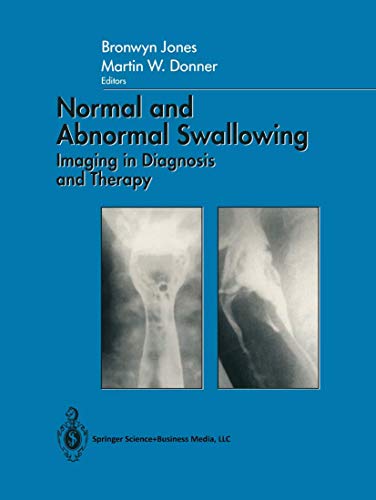 Stock image for Normal and Abnormal Swallowing Imaging in Diagnosis and Therapy for sale by BookHolders