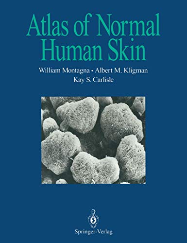 Stock image for Atlas of Normal Human Skin for sale by Reuseabook