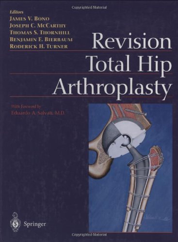 Beispielbild fr Revision Total Hip Arthroplasty zum Verkauf von Midtown Scholar Bookstore