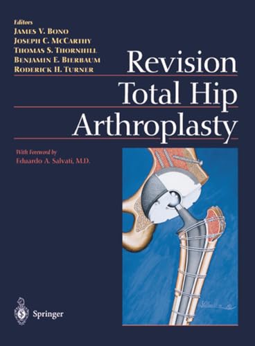 9780387983912: Revision Total Hip Arthroplasty