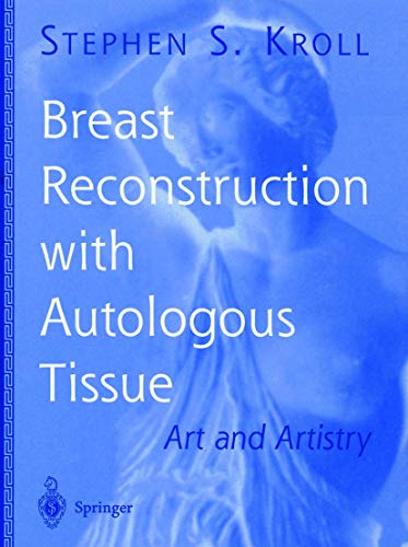 9780387986708: Breast Reconstruction With Autologous Tissue: Art and Artistry