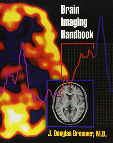 Stock image for Brain Imaging Handbook for sale by HPB-Red
