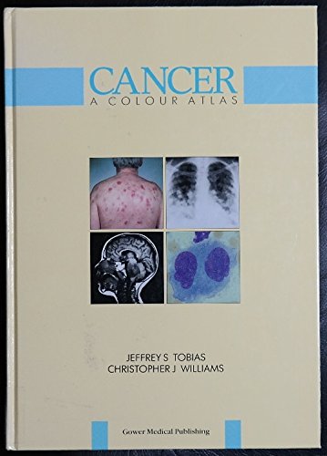 Imagen de archivo de Cancer : A Colour Atlas a la venta por Better World Books