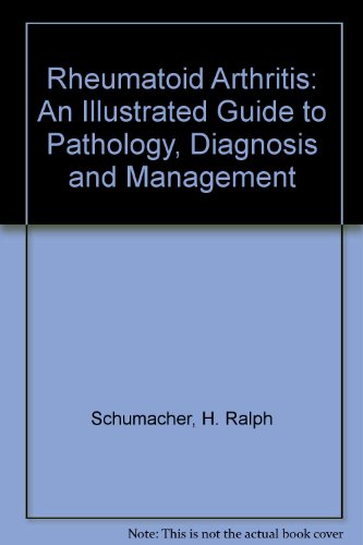 Stock image for Rheumatoid Arthritis: An Illustrated Guide to Pathology, Diagnosis, and Management for sale by Phatpocket Limited