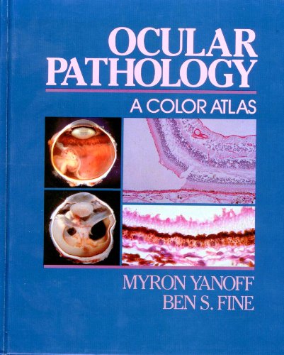 Stock image for Ocular Pathology: A Color Atlas for sale by ThriftBooks-Dallas