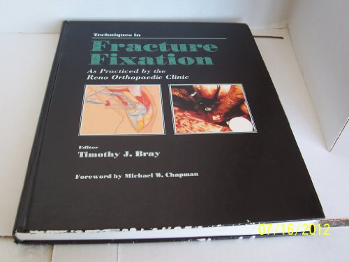 9780397446902: Techniques in Fracture Fixation: As Practised by the Reno Orthopaedic Clinic