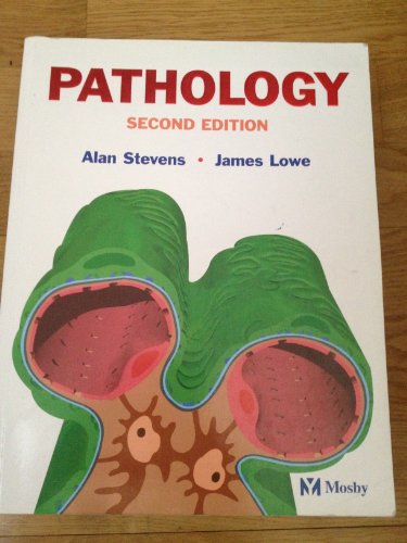 Pathology (9780397447640) by Stevens, Alan; Lowe, James