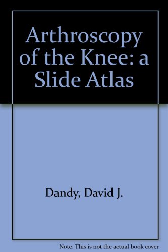 Imagen de archivo de Arthroscopy of the Knee: a Slide Atlas a la venta por Salish Sea Books