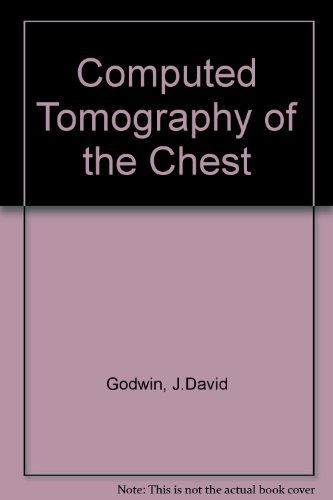 Computed Tomography of the Chest