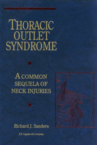 Imagen de archivo de Thoracic Outlet Syndrome: A Common Sequela of Neck Injuries a la venta por Zoom Books Company