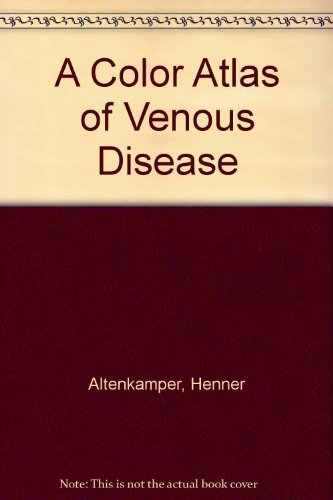 Stock image for Color Atlas Of Venous Disease for sale by Basi6 International