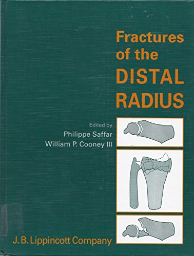 Imagen de archivo de Fractures of the Distal Radius a la venta por Mispah books