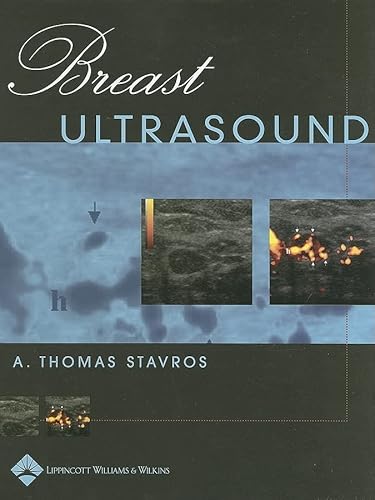 9780397516247: Breast Ultrasound