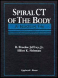 Beispielbild fr Spiral CT of the Body A Teaching File zum Verkauf von Martin Preu / Akademische Buchhandlung Woetzel