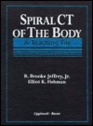 Imagen de archivo de Spiral CT of the Body A Teaching File a la venta por Martin Preu / Akademische Buchhandlung Woetzel