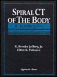 Stock image for Spiral CT of the Body: A Teaching File for sale by ThriftBooks-Dallas