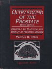 9780397517695: Ultrasound of the Prostate: Imaging in the Diagnosis and Therapy of Prostatic Disease