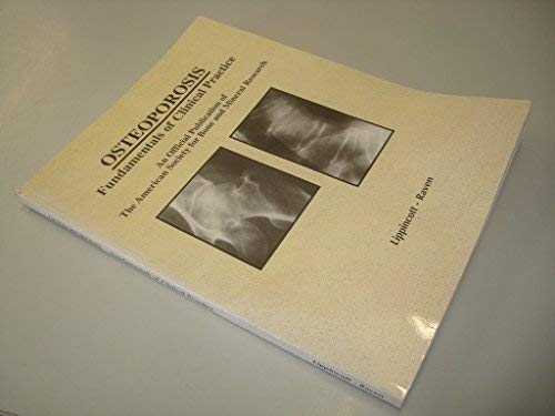 Imagen de archivo de Osteoporosis : Fundamentals of Clinical Practice a la venta por Better World Books Ltd