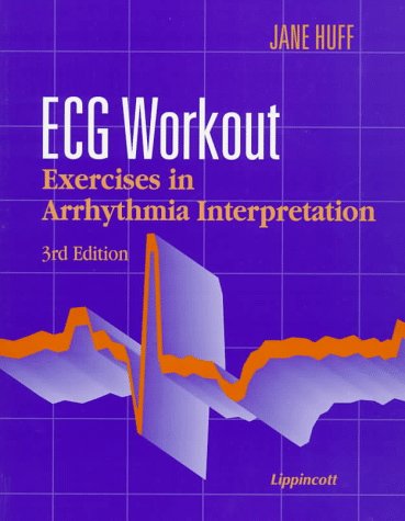 9780397553716: ECG Workout: Exercises in Arrhythmia Interpretation