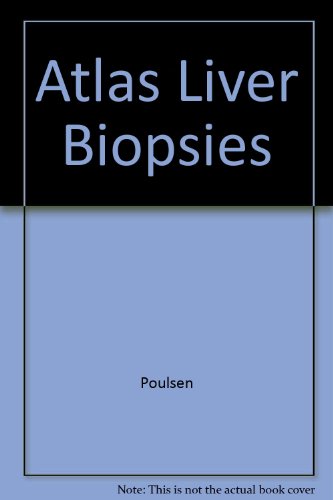 Stock image for Atlas of Liver Biopsies for sale by Stories & Sequels