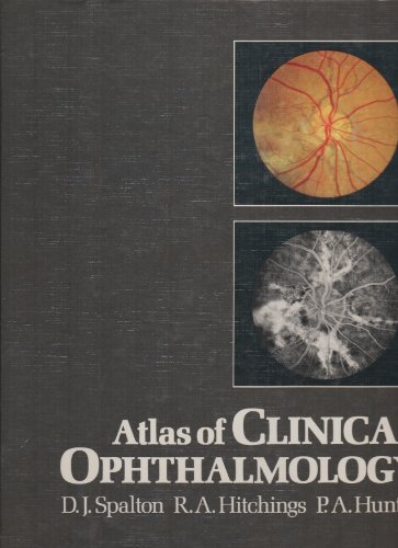 9780397582891: Atlas Clinical Ophthalmology