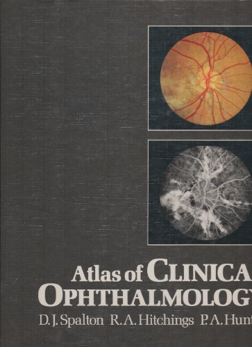 9780397582891: Atlas of Clinical Ophthalmology