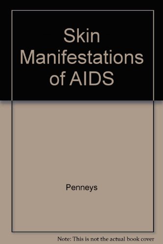 Imagen de archivo de Skin Manifestations of AIDS a la venta por Mispah books