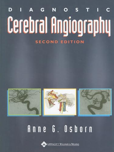 Stock image for Diagnostic Cerebral Angiography for sale by Scubibooks