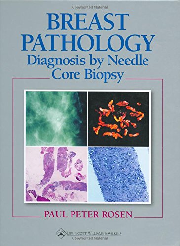 Imagen de archivo de BREAST PATHOLOGY Diagnosis by Needle Core Biopsy a la venta por Riverow Bookshop