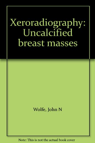 Xeroradiography: Uncalcified Breast Masses