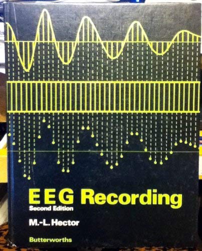 prosa Ernæring melodisk 9780407001367: EEG Recording - AbeBooks - Hector, Marie Louise: 0407001360