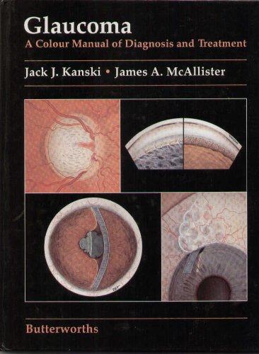 Beispielbild fr Glaucoma: A Colour Manual of Diagnosis and Treatment zum Verkauf von ThriftBooks-Dallas