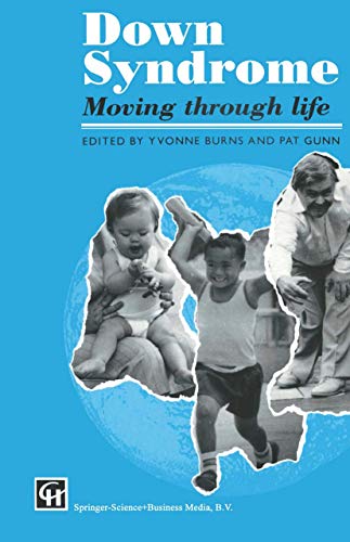 Stock image for Down Syndrome: Moving through life for sale by WorldofBooks