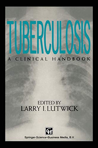 Stock image for Tuberculosis: A Clinical Handbook for sale by Mispah books