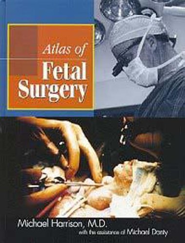 Atlas of Fetal Surgery (9780412991318) by Harrison, Michael