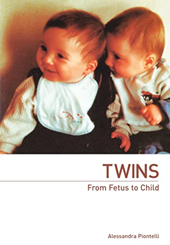 Beispielbild fr Twins - From Fetus to Child zum Verkauf von WorldofBooks