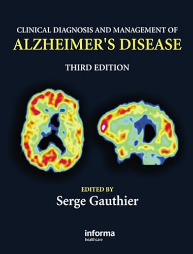 Stock image for Clinical Diagnosis and Management of Alzheimer's Disease for sale by ThriftBooks-Dallas
