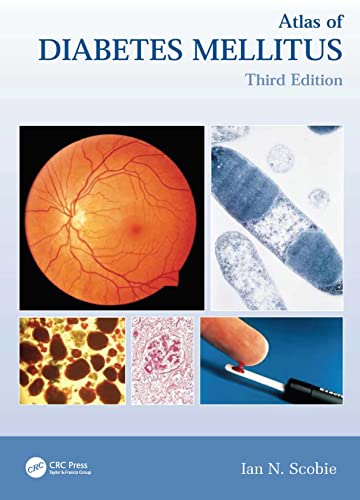 Stock image for Atlas of Diabetes Mellitus (Encyclopedia of Visual Medicine Series) for sale by Anybook.com