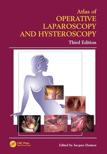 Imagen de archivo de Atlas of Operative Laparoscopy and Hysteroscopy (Encyclopedia of Visual Medicine Series) a la venta por BooksRun