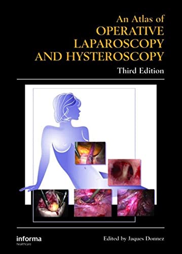 9780415384155: Atlas of Operative Laparoscopy and Hysteroscopy