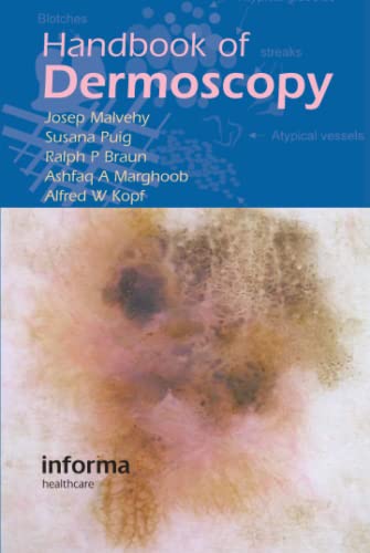 9780415384902: Handbook of Dermoscopy