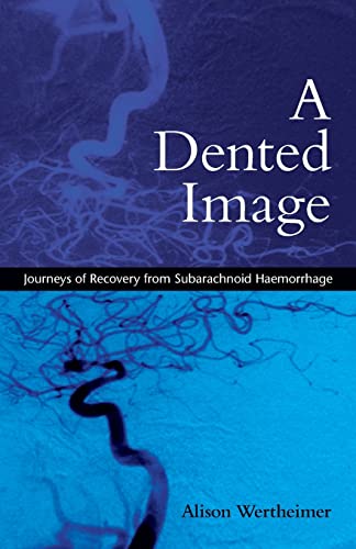 Beispielbild fr A Dented Image: Journeys of Recovery from Subarachnoid Haemorrhage zum Verkauf von Chiron Media