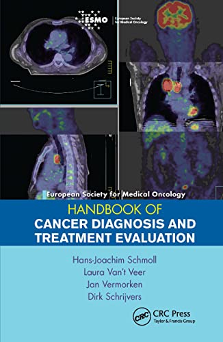 Beispielbild fr European Society for Medical Oncology Handbook of Cancer Diagnosis and Treatment Evaluation zum Verkauf von Revaluation Books