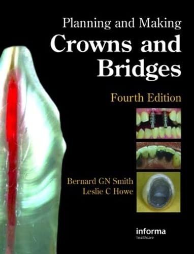 Planning And Making Crowns And Bridges (9780415398503) by SMITH