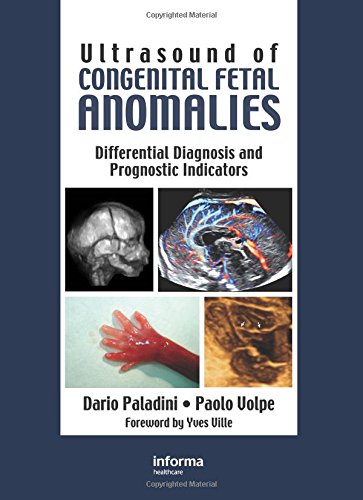 9780415414449: Ultrasound of Congenital Fetal Anomalies: Differential Diagnosis and Prognostic Indicators